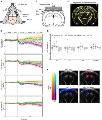 Pharmaco-fUS for Characterizing Drugs for Alzheimer’s Disease – The Case of THN201, a Drug Combination of Donepezil Plus Mefloquine